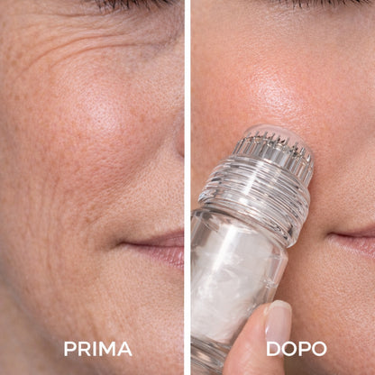 Roll On™ - Set microneedling con applicatore e ricariche